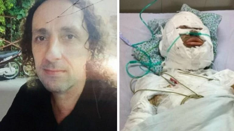 Του ζήτησε να χωρίσουν και την πυρπόλησε από ζήλια – Εικόνα σοκ